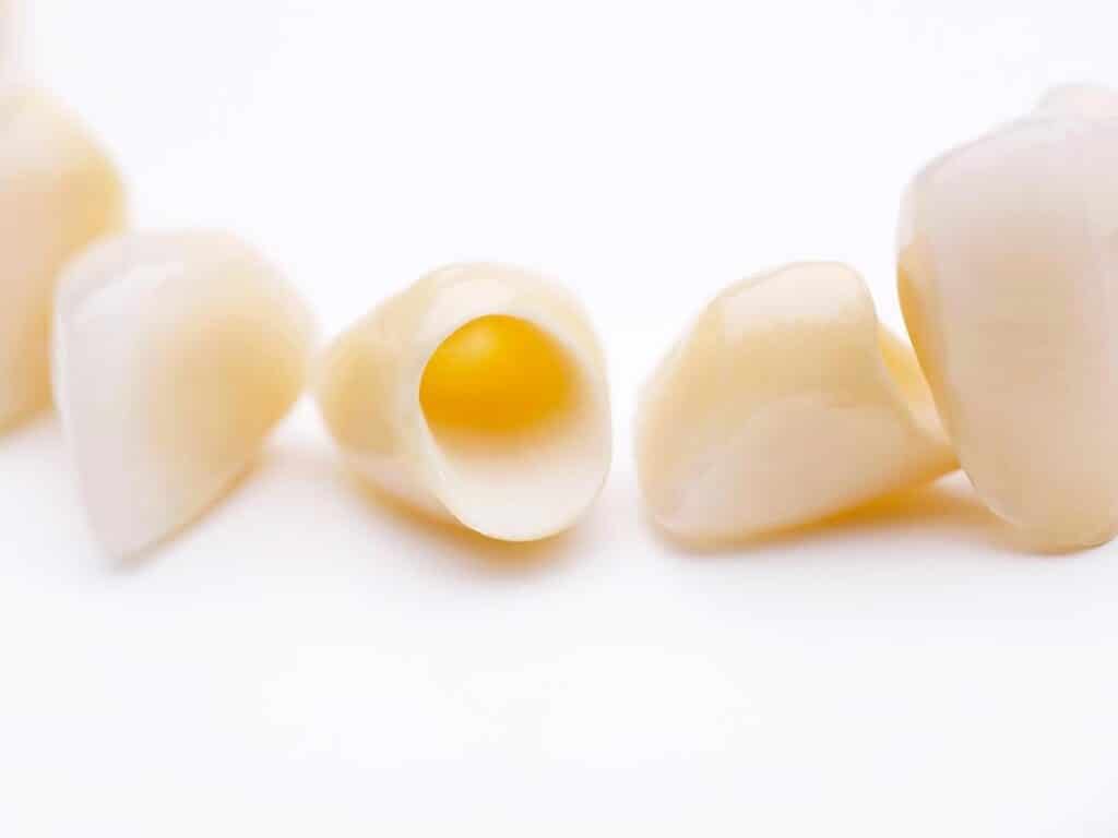 cerec-crowns-and-bridges-littleton–co-gpw-main-service-pg-img Custom dental crowns and ceramic restorations representing same-day CEREC crown technology.