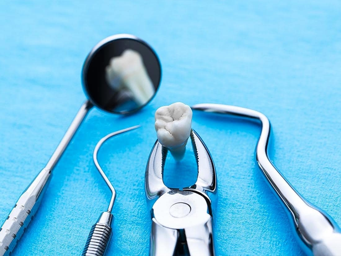 Dental tools and extracted tooth representing dental extraction services