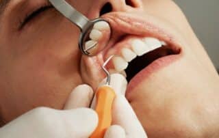 How to Find a Good Dentist in Your Area