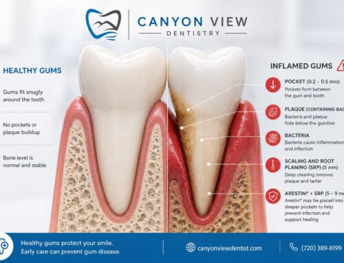 Arestin® and Deep Cleanings: How We Treat Gum Disease More Effectively at Canyon View Dentistry